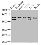 BIRC2 / cIAP1 Antibody - Western Blot Positive WB detected in:Rat liver tissue,Rat skeletal muscle tissue,Mouse heart tissue,Mouse lung tissue,Mouse brain tissue All Lanes:BIRC2 antibody at 3.5µg/ml Secondary Goat polyclonal to rabbit IgG at 1/50000 dilution Predicted band size: 70,65 KDa Observed band size: 70,65 KDa