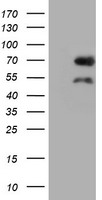 BIRC3 / cIAP2 Antibody - HEK293T cells were transfected with the pCMV6-ENTRY control (Left lane) or pCMV6-ENTRY BIRC3 (Right lane) cDNA for 48 hrs and lysed. Equivalent amounts of cell lysates (5 ug per lane) were separated by SDS-PAGE and immunoblotted with anti-BIRC3.