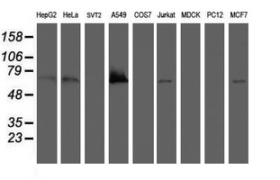 BIRC3 / cIAP2 Antibody - Western blot of extracts (35ug) from 9 different cell lines by using anti-BIRC3 monoclonal antibody (HepG2: human; HeLa: human; SVT2: mouse; A549: human; COS7: monkey; Jurkat: human; MDCK: canine; PC12: rat; MCF7: human).