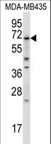 BIRC3 / cIAP2 Antibody - BIRC3 Antibody western blot of MDA-MB435 cell line lysates (35 ug/lane). The BIRC3 antibody detected the BIRC3 protein (arrow).