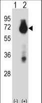 BIRC3 / cIAP2 Antibody - Western blot of BIRC3 (arrow) using rabbit polyclonal BIRC3 Antibody. 293 cell lysates (2 ug/lane) either nontransfected (Lane 1) or transiently transfected (Lane 2) with the BIRC3 gene.
