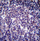 BIRC3 / cIAP2 Antibody - BIRC3 Antibody immunohistochemistry of formalin-fixed and paraffin-embedded human tonsil tissue followed by peroxidase-conjugated secondary antibody and DAB staining.
