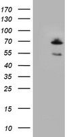 BIRC3 / cIAP2 Antibody - HEK293T cells were transfected with the pCMV6-ENTRY control (Left lane) or pCMV6-ENTRY BIRC3 (Right lane) cDNA for 48 hrs and lysed. Equivalent amounts of cell lysates (5 ug per lane) were separated by SDS-PAGE and immunoblotted with anti-BIRC3.