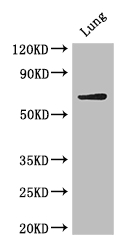 BIRC3 / cIAP2 Antibody - Positive WB detected in:Mouse lung tissue;All lanes: BIRC3 antibody at 4ug/ml;Secondary;Goat polyclonal to rabbit IgG at 1/50000 dilution;Predicted band size: 69 kDa;Observed band size: 69 kDa;
