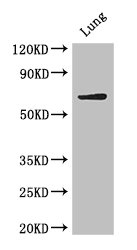 BIRC3 / cIAP2 Antibody - Western Blot Positive WB detected in: Mouse lung tissue All lanes: BIRC3 antibody at 4µg/ml Secondary Goat polyclonal to rabbit IgG at 1/50000 dilution Predicted band size: 69 kDa Observed band size: 69 kDa