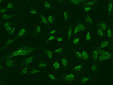 BIRC3 / cIAP2 Antibody - Immunofluorescence staining of BIRC3 in U251MG cells. Cells were fixed with 4% PFA, permeabilzed with 0.1% Triton X-100 in PBS, blocked with 10% serum, and incubated with rabbit anti-Human BIRC3 polyclonal antibody (dilution ratio 1:100) at 4°C overnight. Then cells were stained with the Alexa Fluor 488-conjugated Goat Anti-rabbit IgG secondary antibody (green). Positive staining was localized to Nucleus and cytoplasm.