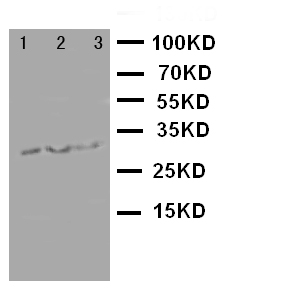 BIRC5 / Survivin Antibody - WB of BIRC5 / Survivin antibody. Lane 1: Recombinant Human Survivin Protein 10ng. Lane 2: Recombinant Human Survivin Protein 5ng. Lane 3: Recombinant Human Survivin Protein 2.5ng..