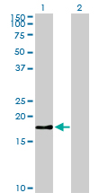 BIRC5 / Survivin Antibody - Western Blot analysis of BIRC5 expression in transfected 293T cell line by BIRC5 monoclonal antibody (M01), clone 5B10.Lane 1: BIRC5 transfected lysate(16.4 KDa).Lane 2: Non-transfected lysate.