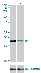 BIRC5 / Survivin Antibody - Western blot analysis of BIRC5 over-expressed 293 cell line, cotransfected with BIRC5 Validated Chimera RNAi (Lane 2) or non-transfected control (Lane 1). Blot probed with BIRC5 monoclonal antibody (M01), clone 5B10 . GAPDH ( 36.1 kDa ) used as specificity and loading control.