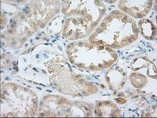 BIRC5 / Survivin Antibody - Immunohistochemical staining of paraffin-embedded Human Kidney tissue using anti-BI mouse monoclonal antibody. (Dilution 1:50).