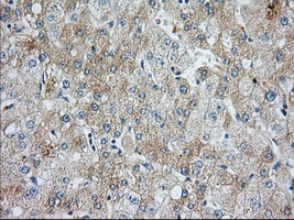 BIRC5 / Survivin Antibody - Immunohistochemical staining of paraffin-embedded Human liver tissue using anti-BI mouse monoclonal antibody. (Dilution 1:50).