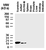 BIRC5 / Survivin Antibody - Western blot of Survivin using Polyclonal Antibody to Survivin at 1:2000. Survivin was detected in the two tumor cell lines, Jurkat (T cell lymphoma) and RS11846 (non-Hodgkins lymphoma), but not in lysates from normal tissues. Survivin RP, full-length recombinant human survivin protein was used as a positive control.