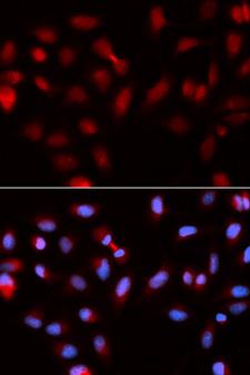 BIRC5 / Survivin Antibody - Immunofluorescence analysis of U2OS cells using BIRC5 antibody. Blue: DAPI for nuclear staining.
