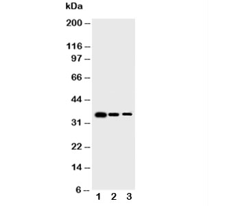 BIRC5 / Survivin Antibody - Western blot testing of Survivin antibody and Lane 1: Recombinant human protein 10ng; 2: 5ng; 3: 2.5ng