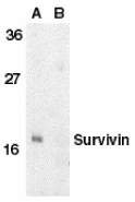 BIRC5 / Survivin Antibody - Western blot of survivin in MOLT4 cell lysate in the absence (A) or presence (B) of blocking peptide with Survivin antibody at 1 ug/ml.