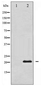 BIRC5 / Survivin Antibody - Western blot of Survivin expression in Mouse lung tissue lysates,The lane on the left is treated with the antigen-specific peptide.