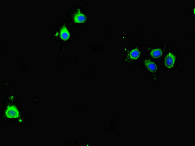 BIRC5 / Survivin Antibody - Immunofluorescent analysis of HeLa cells diluted at 1:100 and Alexa Fluor 488-congugated AffiniPure Goat Anti-Rabbit IgG(H+L)