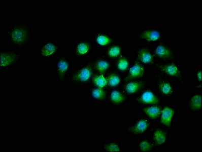 BIRC5 / Survivin Antibody - Immunofluorescence staining of A549 cells with BIRC5 Antibody at 1:266, counter-stained with DAPI. The cells were fixed in 4% formaldehyde, permeabilized using 0.2% Triton X-100 and blocked in 10% normal Goat Serum. The cells were then incubated with the antibody overnight at 4°C. The secondary antibody was Alexa Fluor 488-congugated AffiniPure Goat Anti-Rabbit IgG(H+L).