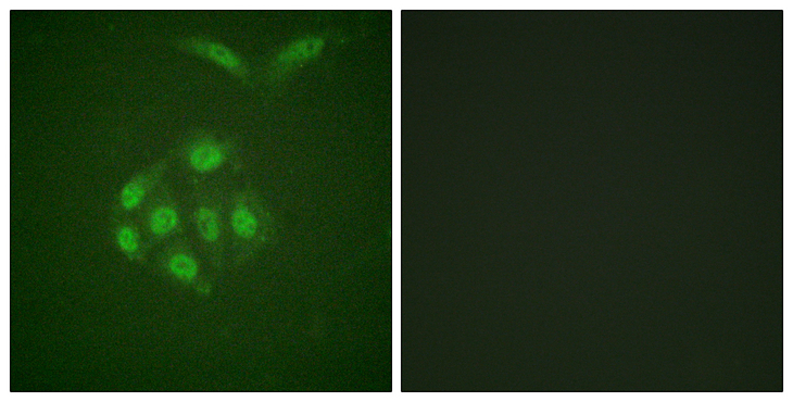 BIRC5 / Survivin Antibody - Immunofluorescence analysis of A549 cells, using Survivin (Phospho-Thr117) Antibody. The picture on the right is blocked with the phospho peptide.