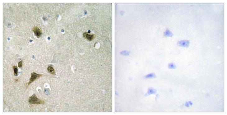 BIRC5 / Survivin Antibody - Immunohistochemistry analysis of paraffin-embedded human brain, using Survivin (Phospho-Thr117) Antibody. The picture on the right is blocked with the phospho peptide.