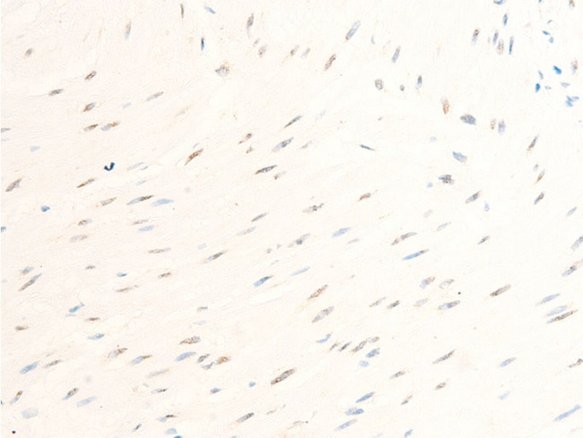 BIRC5 / Survivin Antibody - 1:100 staining human heart tissue by IHC-P. The tissue was formaldehyde fixed and a heat mediated antigen retrieval step in citrate buffer was performed. The tissue was then blocked and incubated with the antibody for 1.5 hours at 22°C. An HRP conjugated goat anti-rabbit antibody was used as the secondary.