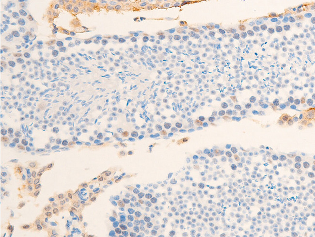 BIRC5 / Survivin Antibody - 1:100 staining mouse testis tissue by IHC-P. The tissue was formaldehyde fixed and a heat mediated antigen retrieval step in citrate buffer was performed. The tissue was then blocked and incubated with the antibody for 1.5 hours at 22°C. An HRP conjugated goat anti-rabbit antibody was used as the secondary.