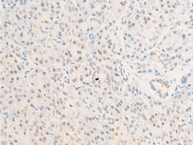 BIRC5 / Survivin Antibody - 1:100 staining human pancreas tissue by IHC-P. The tissue was formaldehyde fixed and a heat mediated antigen retrieval step in citrate buffer was performed. The tissue was then blocked and incubated with the antibody for 1.5 hours at 22°C. An HRP conjugated goat anti-rabbit antibody was used as the secondary.