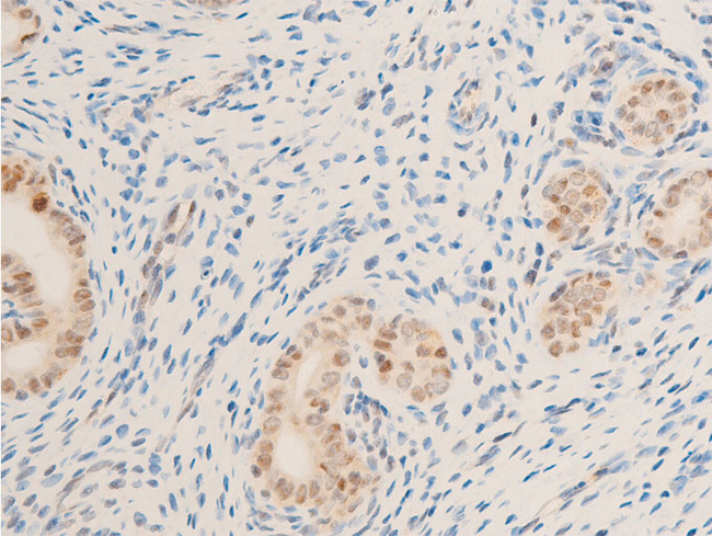 BIRC5 / Survivin Antibody - 1:100 staining rat uterine tissue by IHC-P. The tissue was formaldehyde fixed and a heat mediated antigen retrieval step in citrate buffer was performed. The tissue was then blocked and incubated with the antibody for 1.5 hours at 22°C. An HRP conjugated goat anti-rabbit antibody was used as the secondary.