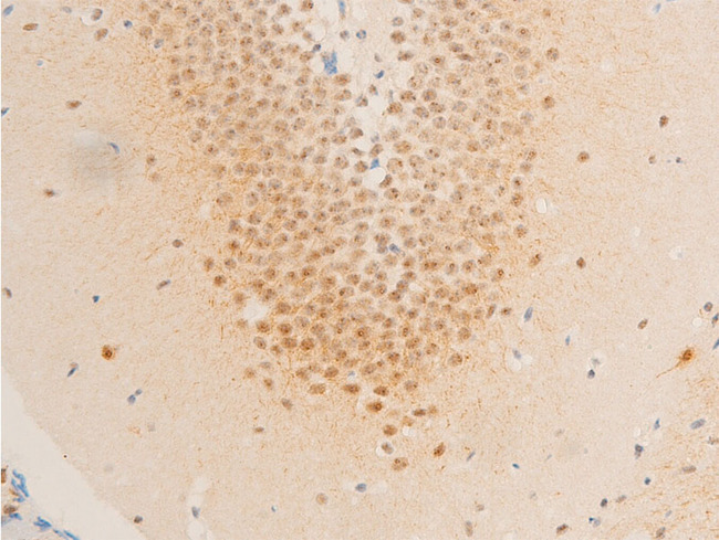 BIRC5 / Survivin Antibody - 1:100 staining mouse brain tissue by IHC-P. The tissue was formaldehyde fixed and a heat mediated antigen retrieval step in citrate buffer was performed. The tissue was then blocked and incubated with the antibody for 1.5 hours at 22°C. An HRP conjugated goat anti-rabbit antibody was used as the secondary.