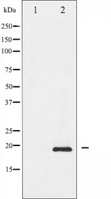 BIRC5 / Survivin Antibody - Western blot analysis of Survivin phosphorylation expression in A549 whole cells lysates. The lane on the left is treated with the antigen-specific peptide.