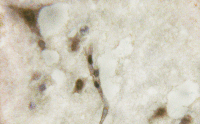 BIRC5 / Survivin Antibody - 1/100 staining human brain tissue by IHC-P. The sample was formaldehyde fixed and a heat mediated antigen retrieval step in citrate buffer was performed. The sample was then blocked and incubated with the antibody for 1.5 hours at 22°C. An HRP conjugated goat anti-rabbit antibody was used as the secondary antibody.
