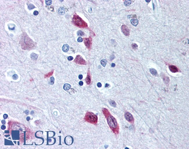 BIRC5 / Survivin Antibody - Anti-BIRC5 / Survivin antibody IHC of human brain, cortex. Immunohistochemistry of formalin-fixed, paraffin-embedded tissue after heat-induced antigen retrieval. Antibody concentration 5 ug/ml.  This image was taken for the unconjugated form of this product. Other forms have not been tested.