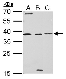 BIRC7 / Livin Antibody - Livin antibody detects BIRC7 protein by Western blot analysis. A. 30 ug 293T whole cell lysate/extract. B. 30 ug A431 whole cell lysate/extract. C. 30 ug HepG2 whole cell lysate/extract. 12 % SDS-PAGE. Livin antibody dilution:1:500
