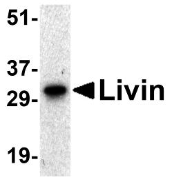 BIRC7 / Livin Antibody - Western blot analysis of Livin expression in human Raji cell lysate with Livin antibody at 0.5µg/ml.