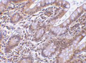 BIRC7 / Livin Antibody - Immunohistochemical staining of Livin in human small intestine with Livin antibody at 5µg/ml.