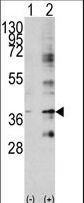 BIRC7 / Livin Antibody - Western blot of BIRC7 (arrow) using rabbit polyclonal BIRC7 Antibody. 293 cell lysates (2 ug/lane) either nontransfected (Lane 1) or transiently transfected with the BIRC7 gene (Lane 2) (Origene Technologies).