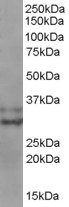 BIRC7 / Livin Antibody - Staining (0.3 ug/ml) of MOLT4 lysate (RIPA buffer, 35 ug total protein per lane). Primary incubated for 1 hour. Detected using chemiluminescence.
