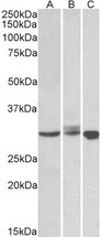 BIRC7 / Livin Antibody - Staining (0.5?g/ml) of Daudi (A), Jurkat (B) and K562 (C) lysates (35?g protein in RIPA buffer). Primary incubation was 1 hour. Detected by chemiluminescence.
