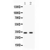 BIRC7 / Livin Antibody - Livin antibody Western blot. All lanes: Anti Livin at 0.5 ug/ml. Lane 1: HELA Whole Cell Lysate at 40 ug. Lane 2: A431 Whole Cell Lysate at 40 ug. Predicted band size: 33 kD. Observed band size: 33 kD.