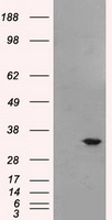 BIRC7 / Livin Antibody - HEK293T cells were transfected with the pCMV6-ENTRY control (Left lane) or pCMV6-ENTRY BI (Right lane) cDNA for 48 hrs and lysed. Equivalent amounts of cell lysates (5 ug per lane) were separated by SDS-PAGE and immunoblotted with anti-BI.