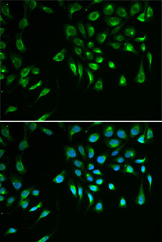 BIRC7 / Livin Antibody - Immunofluorescence analysis of U2OS cells using BIRC7 antibody. Blue: DAPI for nuclear staining.