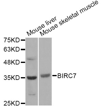 BIRC7 / Livin Antibody - Western blot analysis of extracts of various cell lines, using BIRC7 Antibody at 1:1000 dilution. The secondary antibody used was an HRP Goat Anti-Rabbit IgG (H+L) at 1:10000 dilution. Lysates were loaded 25ug per lane and 3% nonfat dry milk in TBST was used for blocking.