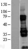 BIRC7 / Livin Protein - Western validation with an anti-DDK antibody * L: Control HEK293 lysate R: Over-expression lysate