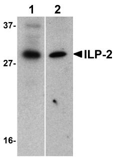 BIRC8 / ILP2 Antibody - Western blot analysis of ILP-2 in human HepG2 (lane 1) and MOLT4 (lane 2) cell lysates with ILP-2 antibody at 1µg/ml.