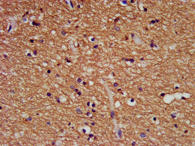 Bis(5'-adenosyl)-triphosphatase Antibody - IHC image of FHIT Antibody diluted at 1:500 and staining in paraffin-embedded human brain tissue performed on a Leica BondTM system. After dewaxing and hydration, antigen retrieval was mediated by high pressure in a citrate buffer (pH 6.0). Section was blocked with 10% normal goat serum 30min at RT. Then primary antibody (1% BSA) was incubated at 4°C overnight. The primary is detected by a biotinylated secondary antibody and visualized using an HRP conjugated SP system.