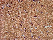 Bis(5'-adenosyl)-triphosphatase Antibody - IHC image of FHIT Antibody diluted at 1:500 and staining in paraffin-embedded human brain tissue performed on a Leica BondTM system. After dewaxing and hydration, antigen retrieval was mediated by high pressure in a citrate buffer (pH 6.0). Section was blocked with 10% normal goat serum 30min at RT. Then primary antibody (1% BSA) was incubated at 4°C overnight. The primary is detected by a biotinylated secondary antibody and visualized using an HRP conjugated SP system.