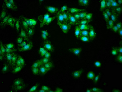 Bis(5'-adenosyl)-triphosphatase Antibody - Immunofluorescence staining of HepG2 cells with FHIT Antibody at 1:166, counter-stained with DAPI. The cells were fixed in 4% formaldehyde, permeabilized using 0.2% Triton X-100 and blocked in 10% normal Goat Serum. The cells were then incubated with the antibody overnight at 4°C. The secondary antibody was Alexa Fluor 488-congugated AffiniPure Goat Anti-Rabbit IgG(H+L).