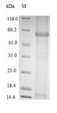 BK Virus VP1 Protein - (Tris-Glycine gel) Discontinuous SDS-PAGE (reduced) with 5% enrichment gel and 15% separation gel.