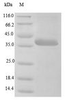 Minor Capsid Protein VP2 Protein - (Tris-Glycine gel) Discontinuous SDS-PAGE (reduced) with 5% enrichment gel and 15% separation gel.