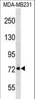 BLAP75 / RMI1 Antibody - RMI1 Antibody western blot of MDA-MB231 cell line lysates (35 ug/lane). The RMI1 antibody detected the RMI1 protein (arrow).